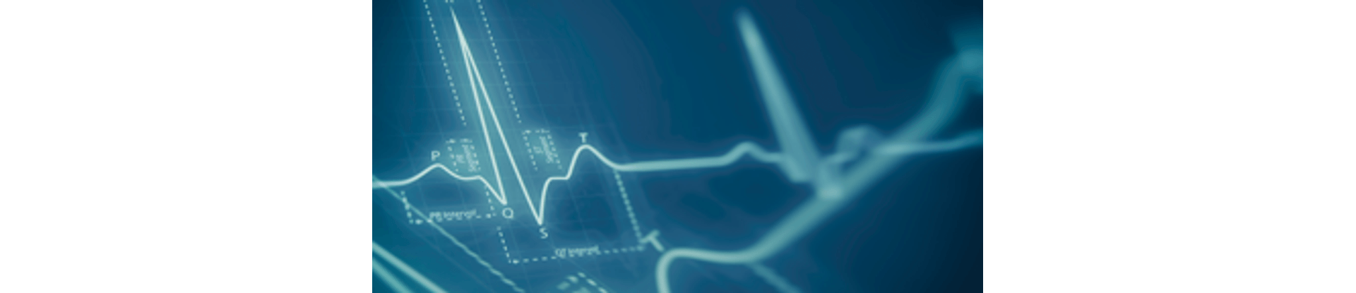 300x144_ecg-basico 300x144_ecg-basico