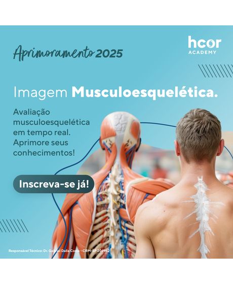 240812_Imagem-Musculoesquelética-Feed