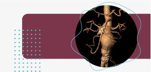 BANNER-300X144-SEM-TEXTO