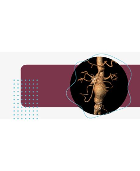 BANNER-300X144-SEM-TEXTO