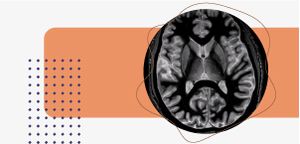 300X144_neurorradiologia