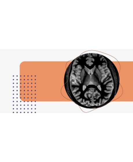 300X144_neurorradiologia