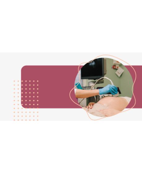 BANNER-300X144-SEM-TEXTO