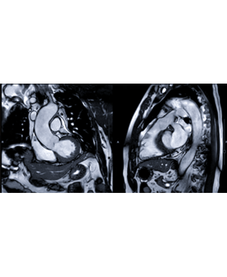 vitrine_tomo-resson-cardiovasc_baixa