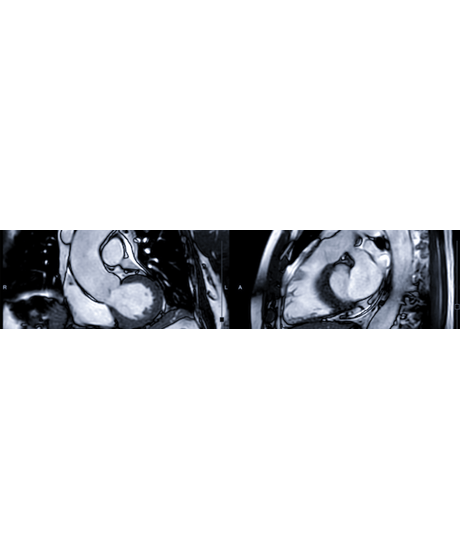 tomo-resson-cardiovasc_alta