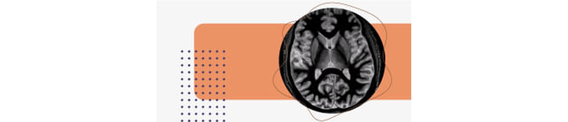 Anuidade Programa Aprimoramento Neurorradiologia Diagnóstica Anuidade 2026 Anuidade Programa Aprimoramento Neurorradiologia Diagnóstica Anuidade 2026