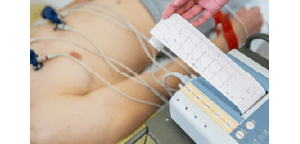 eletrocardiograma-eletrocardiografiainiciante-curso