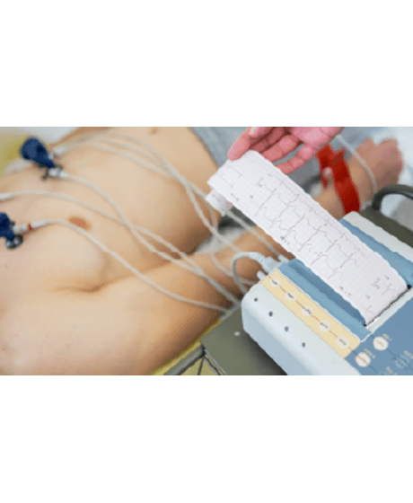 eletrocardiograma-eletrocardiografiainiciante-curso